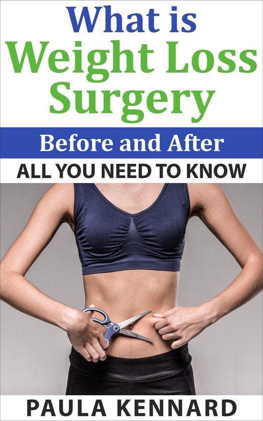 What Is Weight Loss Surgery: All You Need To Know Before And ... - cover