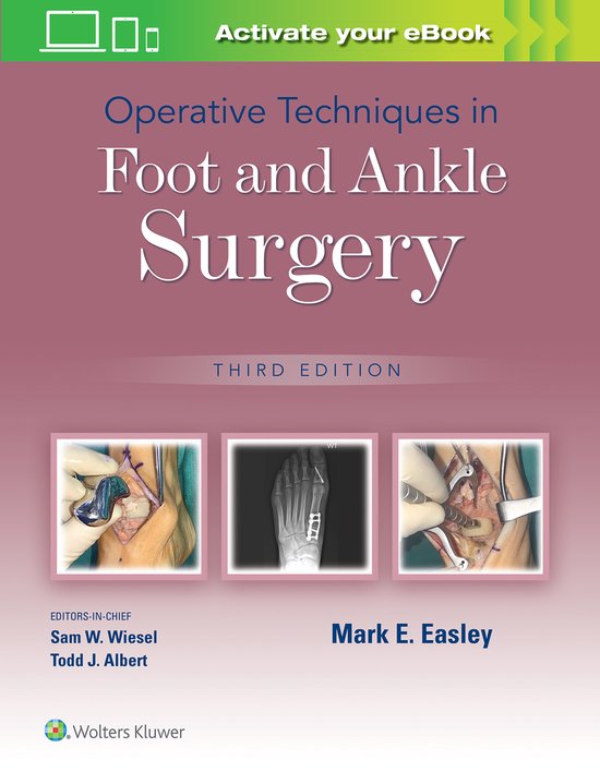 Operative Techniques in Foot and Ankle Surgery - cover