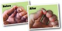 Twee close-ups van handen; de ene toont droge, gebarsten nagelriemen en de andere toont verbeterde nagelriemen. Links 'Voor', rechts 'Na'.