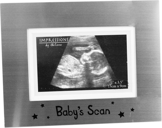 Cadre photo en bois Deknudt pour échographie de grossesse