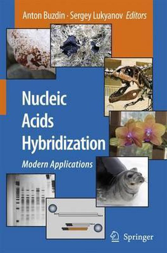 Nucleic Acids Hybridization, Anton Buzdin 9789048175123 Boeken