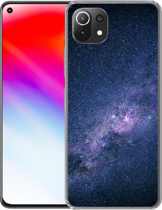 Coque Xiaomi 11T - Voie lactée - Etoiles - Espace - Garçons - Filles - Enfants - Coque en Siliconen