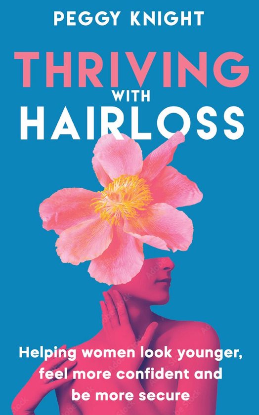 Thriving With Hairloss - cover