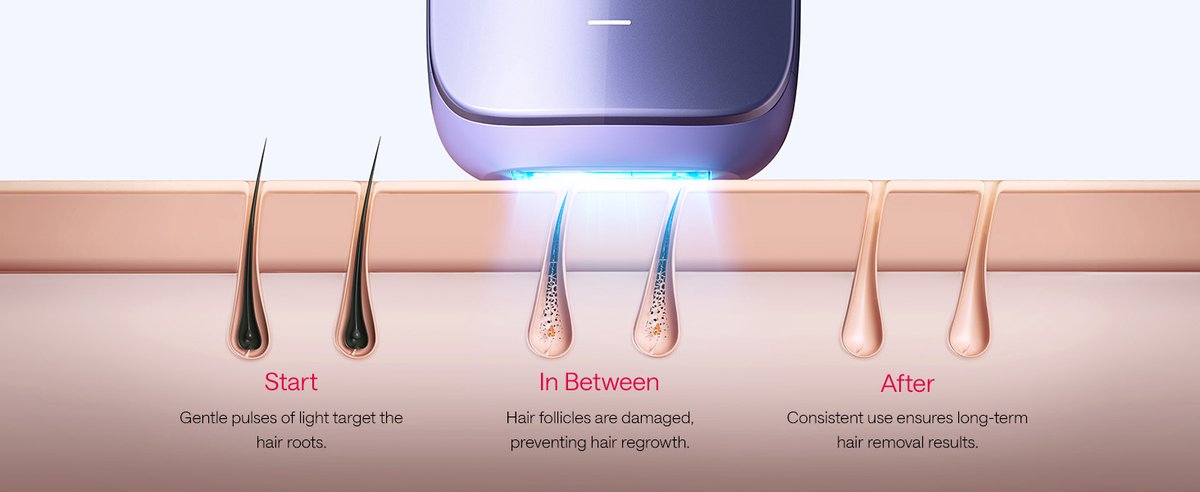 ULIKE Air3 Plus IPL - Provence Purple - Laser Ontharing Apparaat - IPL Ontharing voor Vrouwen en Mannen met Saffier Ice Cooling - Bijna pijnloos - Langdurige Resultaten voor Gezicht en Lichaam - Geschenkdoos thumbnail 3