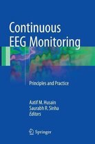 Continuous Eeg Monitoring: Principles and Practice