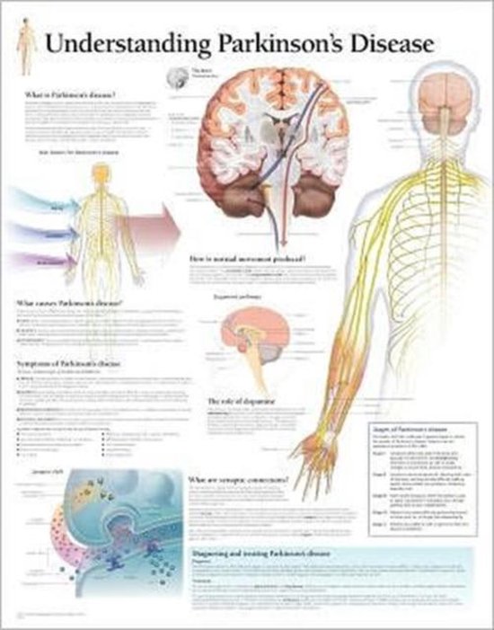 Foto: Understanding parkinson s laminated poster