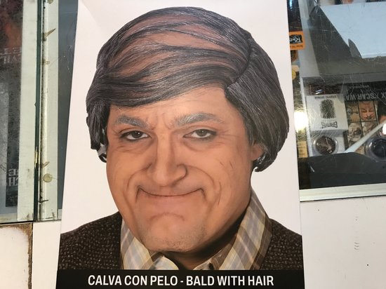 Kale Kop Oude Man Met Laatste Haar