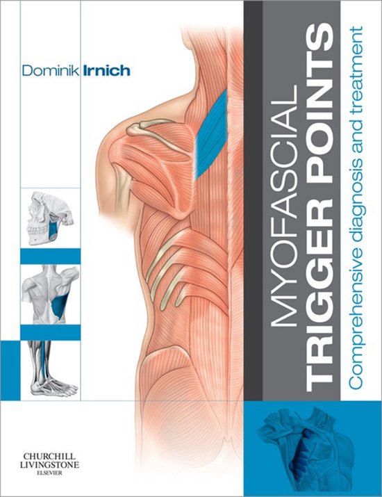 Myofascial Trigger Points - cover