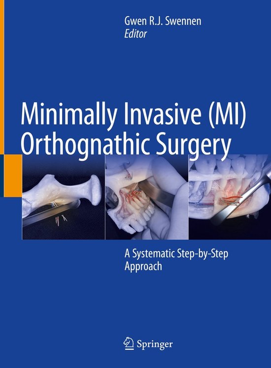 Minimally Invasive (MI) Orthognathic Surgery - cover