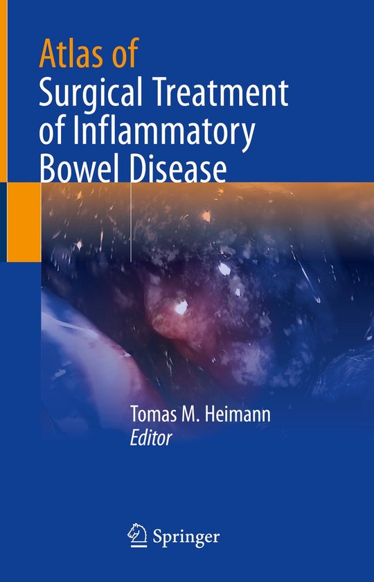 Atlas of Surgical Treatment of Inflammatory Bowel Disease - cover