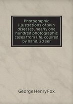 Photographic illustrations of skin diseases, nearly one hundred photographic cases from life, colored by hand. 2d ser