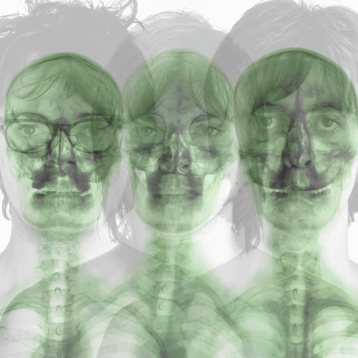 Supergrass - Supergrass (2 CD) (Remastered) (Deluxe Edition)