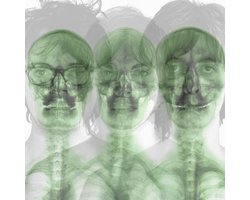 Supergrass - Supergrass (2 CD) (Remastered) (Deluxe Edition)