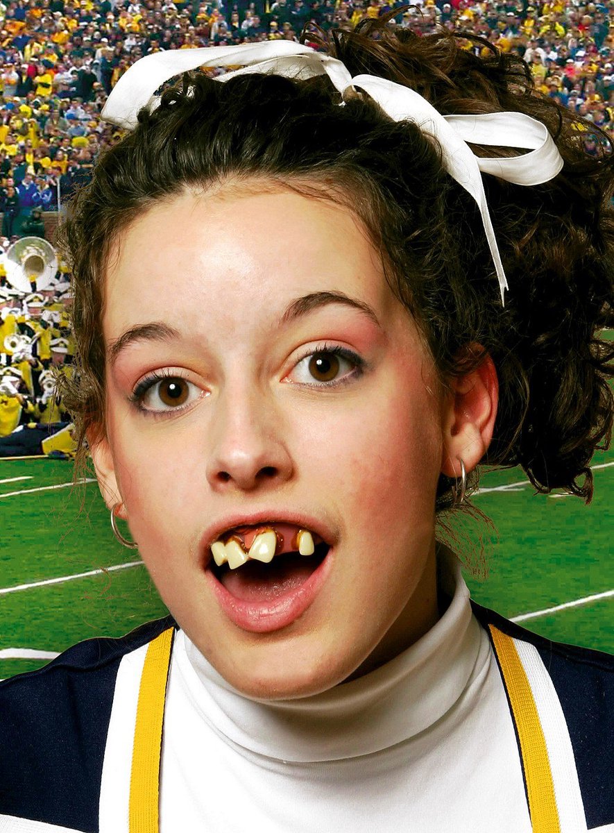 Cheerleader Tanden