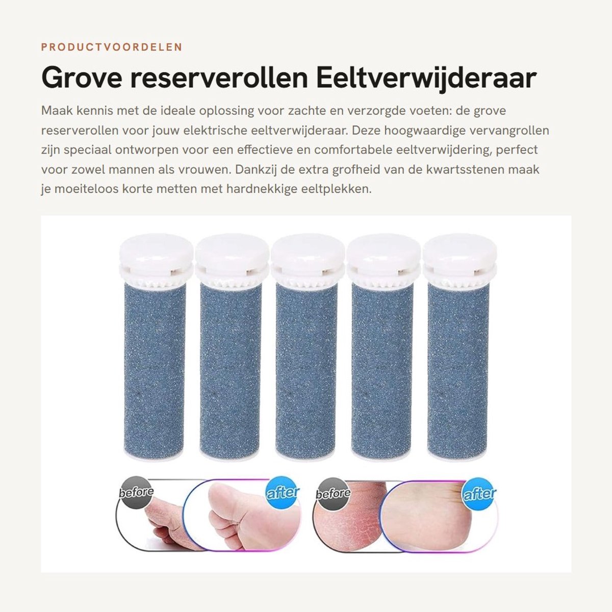 Dailygoods - Grove reserverollen - Eeltverwijderaar - Wasbaar en duurzaam - Extra grof - Pedicure-gereedschap - Geschikt voor uniseks voeten