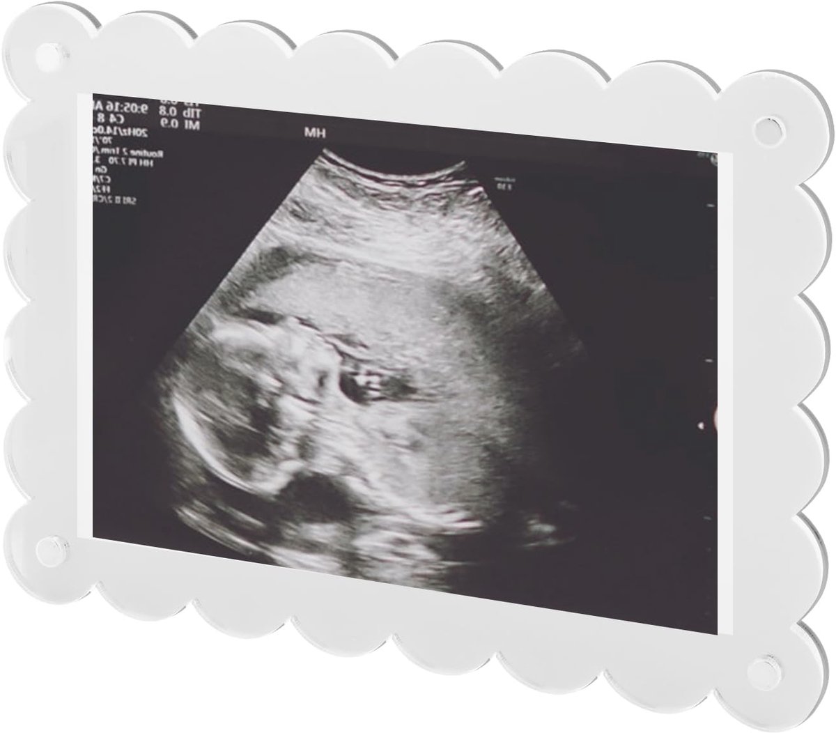 Gegolfd Acryl Fotolijstje, 18x13cm Zwangerschapsaankondiging Fotolijstje Aandenken voor Geslachtsonthulling Cadeau voor Aanstaande Ouders (Transparant)