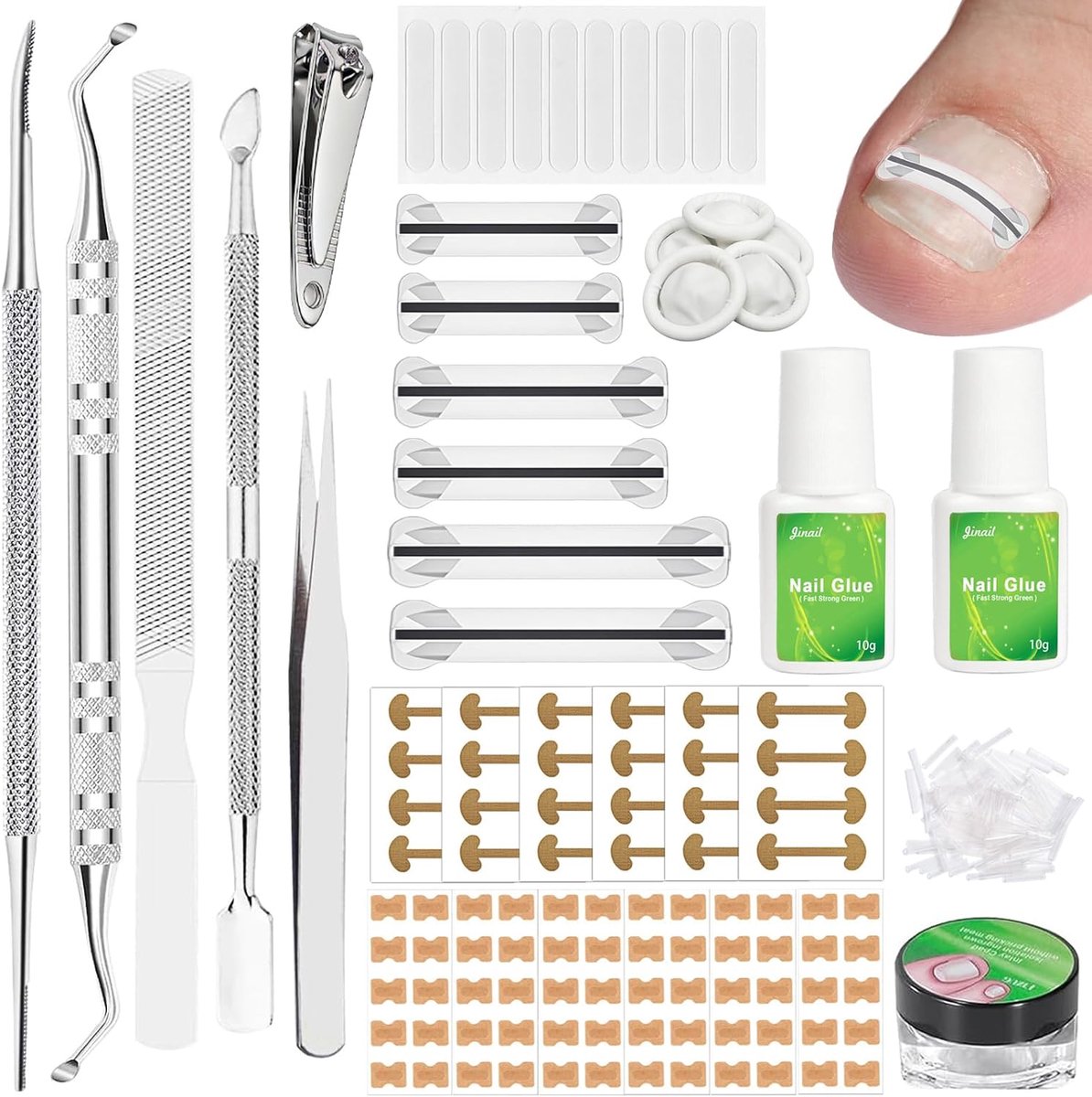 Teennagel correctie patch set - nagelcorrectiespand - ingegroeide teennagels - pijnverlichting - ShopVlot
