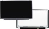 OEM 15.6 inch LCD scherm 1366x768 Glans 30Pin eDP