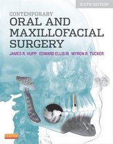 Contemporary Oral and Maxillofacial Surgery - E-Book