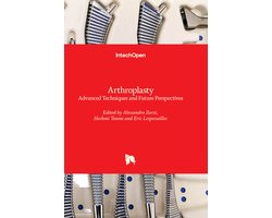 Arthroplasty