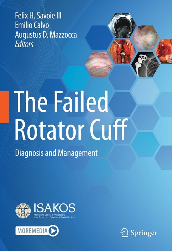 The Failed Rotator Cuff - cover