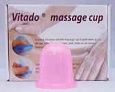 Massage cup voor cupping, siliconen 5,5 cm kleur roze