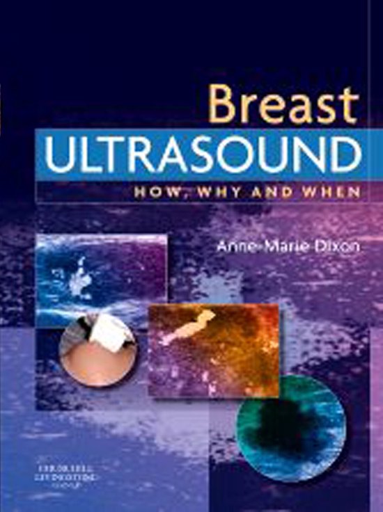 How, Why and When - E-Book - Breast Ultrasound - cover