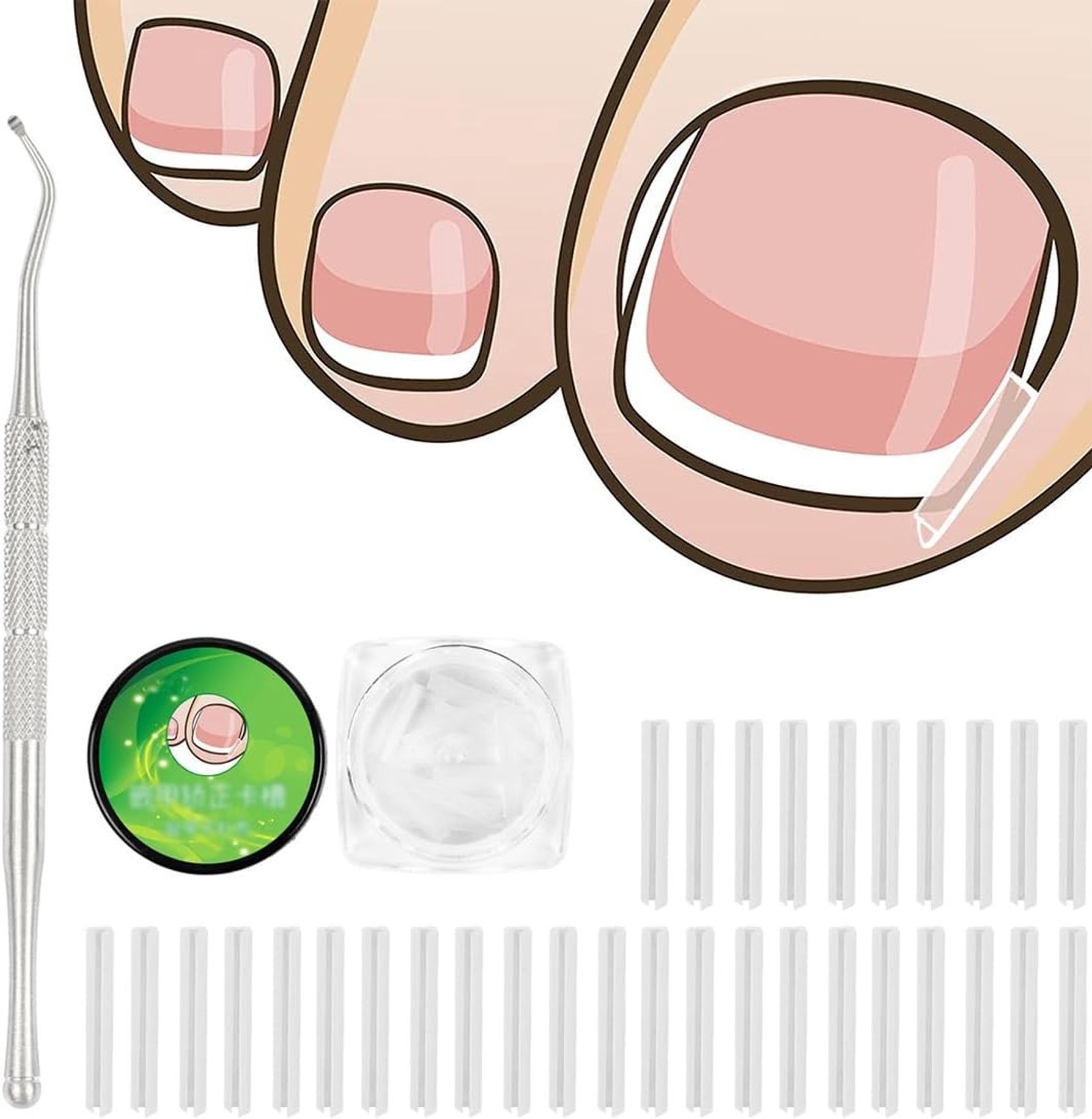 50 Stuks Nagelclips, Set voor het Corrigeren van Ingroeiende Teennagels, Pijnloze Teennagel Strips en Lifter voor Effectieve Nagelverzorging