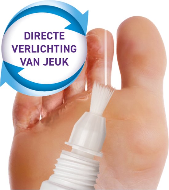 Mycosan precisie kwastje wordt aangebracht op een voet met voetschimmel. Tekst: Directe verlichting van jeuk.