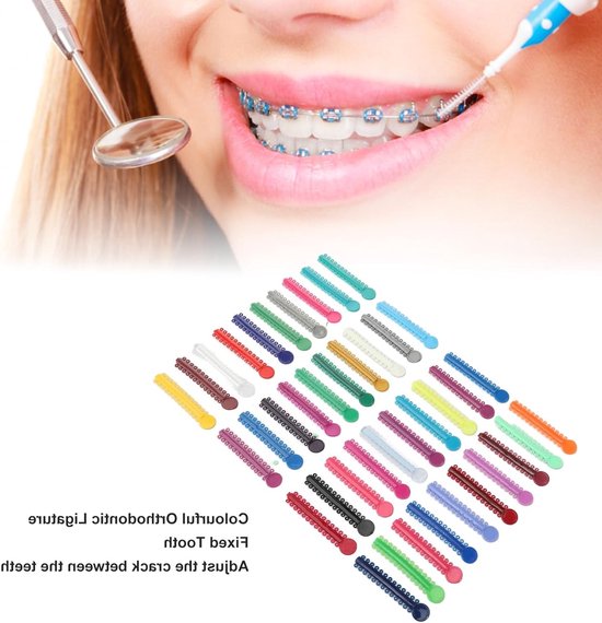 Kleurige orthodontische ligatuur elastieken – 40 stuks plastic dental ligatuur ringen voor beugels en tandcorrectie — afbeelding 4