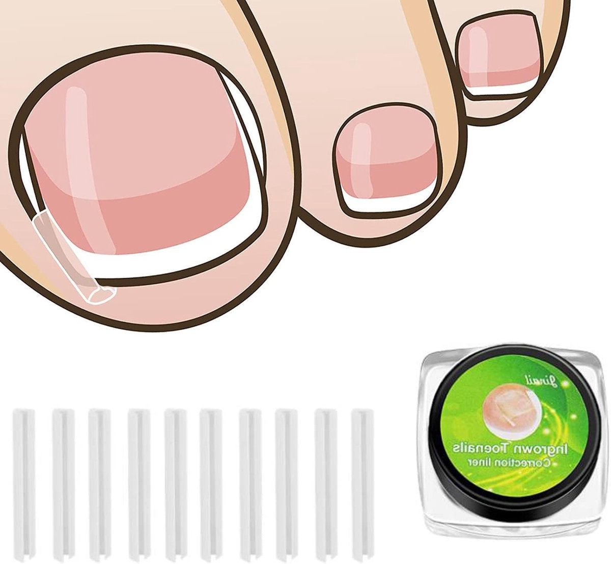 Ingrown Toenail Corrector Strips voor Effectieve Behandeling van Ingegroeide Teennagels, 50 Stuks, Pedicure Tool voor Voetverzorging en Paronychia Herstel