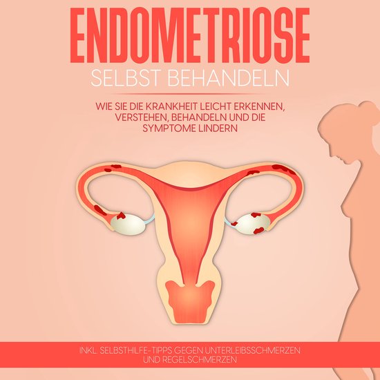 Endometriose selbst behandeln: Wie Sie die Krankheit leicht  ... - cover