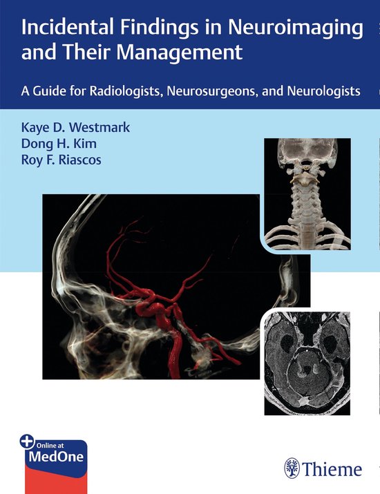 Incidental Findings in Neuroimaging and Their Management - cover