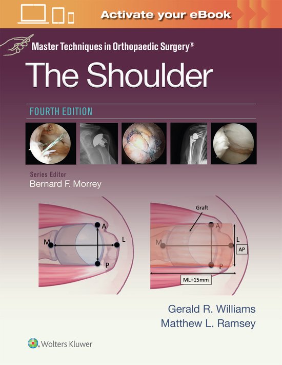 Master Techniques in Orthopaedic Surgery: The Shoulder: Prin ... - cover
