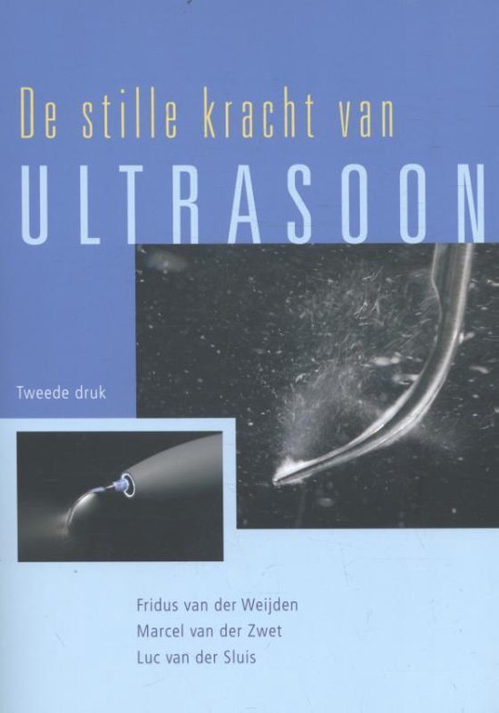 De stille kracht van Ultrasoon - cover