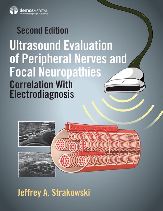 Ultrasound Evaluation of Peripheral Nerves and Focal Neuropa ... - cover