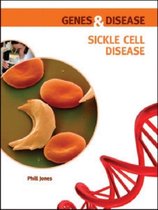 Genes and Disease- Sickle Cell Disease