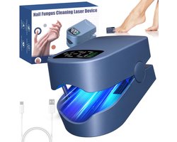 Solene Schimmel Nagel Laser - Schimmelnagel Laser - Anti Schimmel Laser Apparaat - 7 Minuten Thuisbehandeling - Kalknagel Verwijderaar - Kalknagelbehandeling - Pedicure/Manicure