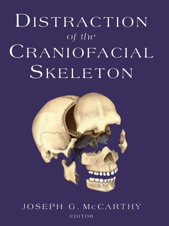 Distraction of the Craniofacial Skeleton - cover