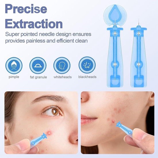 NIUSIMAN 20 stuks 13G piercingnaalden, roestvrijstalen holle naalden, wegwerpbare steriele oorpiercingkit, naald voor neus, septum, oortragus, helix, wenkbrauwlippen, labret piercing NIUSIMAN 20 stuks 13G piercingnaalden, roestvrijstalen holle naalden, wegwerpbare steriele oorpiercingkit, naald voor neus, septum, oortragus, helix, wenkbrauwlippen, labret piercing