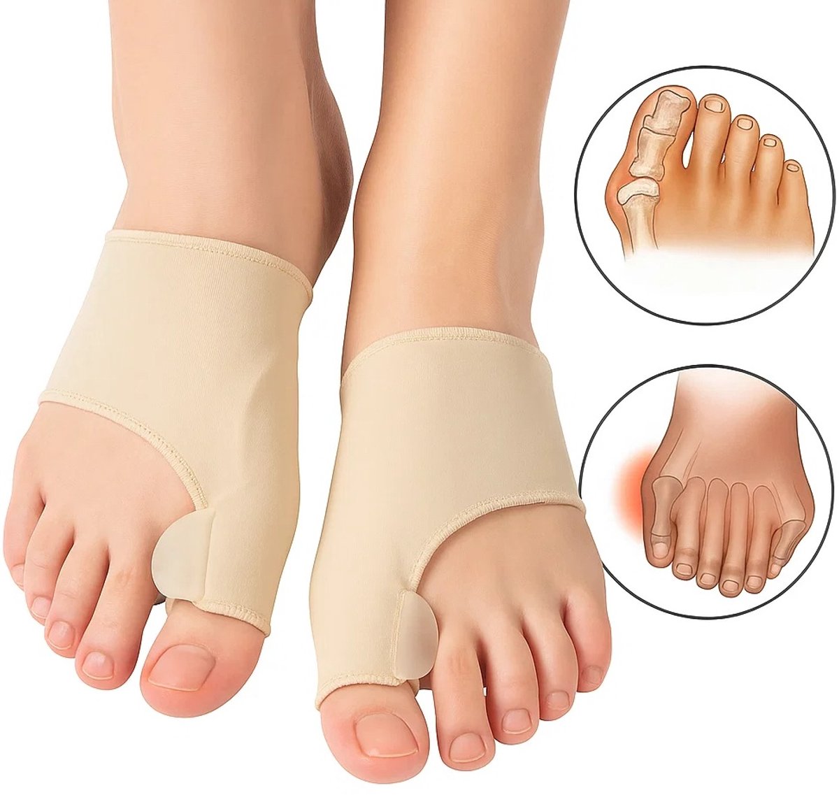 Goedkoopste Hallux Valgus Teenbeschermers 2 Stuk I Teenspreiders I Teen Corrector I Knobbel I Bunion I Eeltknobbel | Teen Rechtzetten I Beige
