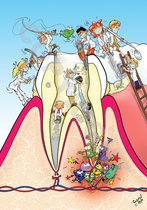 POSTER Cartoon - Tandarts, Mondhygiënist, Orthodontist - Doorsnede kies - 70 x 100 cm door Roland Hols