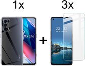 Oppo Find X3 Lite hoesje siliconen case transparant - 3x Oppo Find X3 Lite Screenprotector