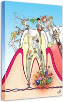 Tandarts Cartoon op canvas - Roland Hols - Doorsnede kies - 60 x 40 cm - Houten frame 4 cm dik - Orthodontist - Mondhygiënist