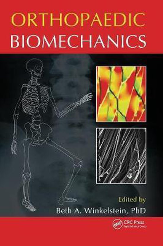 Orthopaedic Biomechanics 9781439860939 Beth A. Winkelstein Boeken