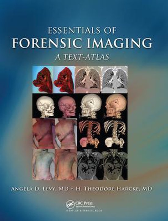 Essentials of Forensic Imaging 9780367577025 Angela D. Levy