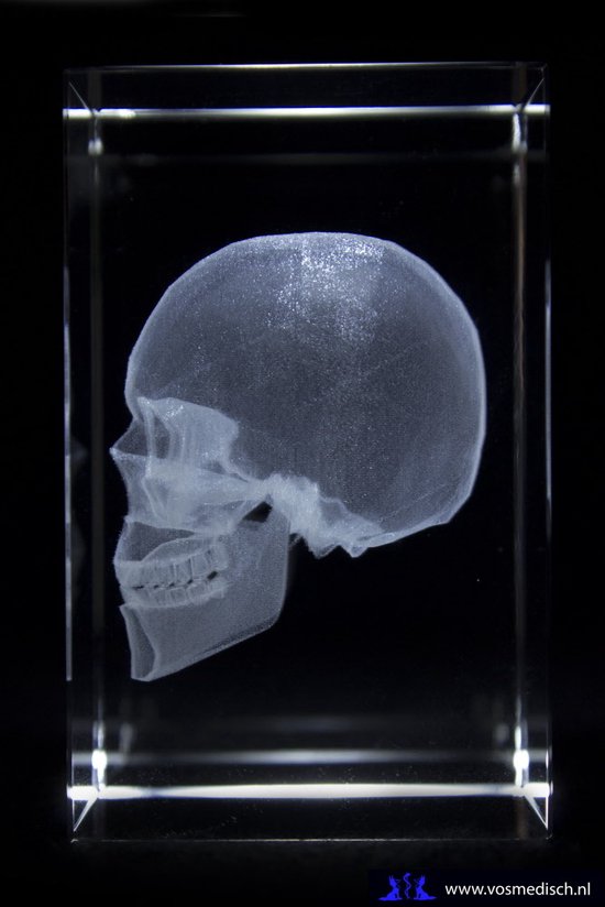 Crâne modèle Anatomie - bloc de verre 3D - cadeau infirmière/ cadeau médecin/ cadeau médecine