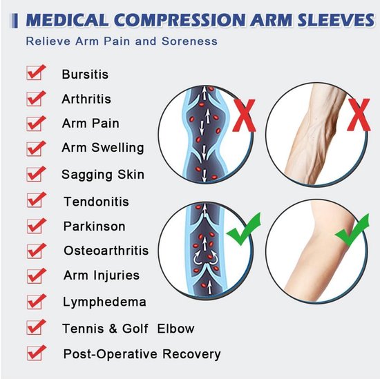 Mouwen Elleboogsteunen, Volledige Arm Ondersteunt Bescherming voor Mannen & Vrouwen (Paar), Antislip Sport Arm Braces — afbeelding 4