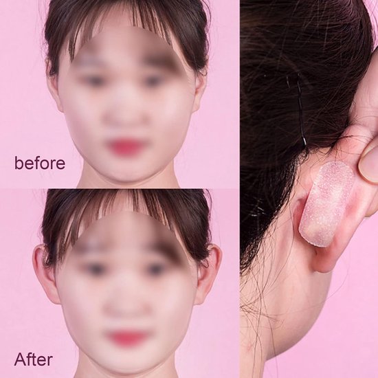 30 stuks cosmetische oorconcealers voor oren, floppy cosmetische stickers, oor-cosmetica, transparant, pijnvrij, voor volwassenen en kinderen, onzichtbaar — afbeelding 2
