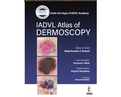 Atlas of Dermoscopy